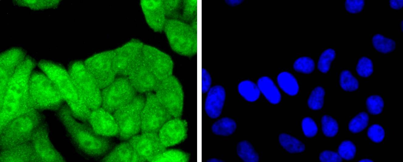Anti-p16-INK4a Antibody (7Y998)