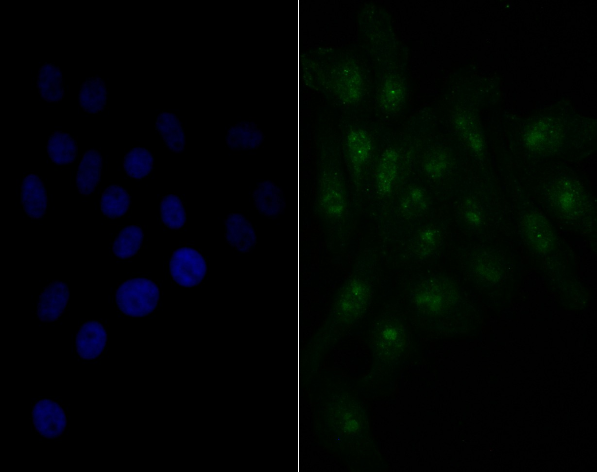 Anti-Nucleostemin Antibody (4J11)