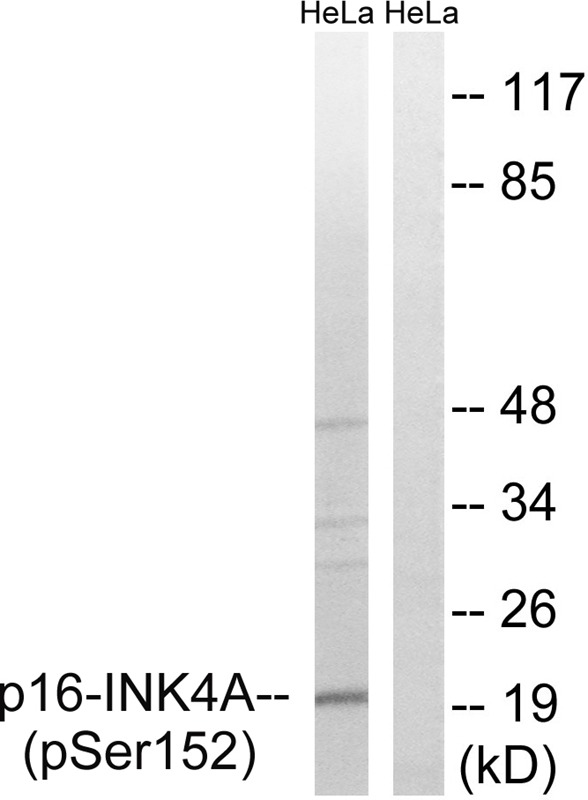 Anti-Phospho-p16-INK4a (Ser152) Polyclonal Antibody