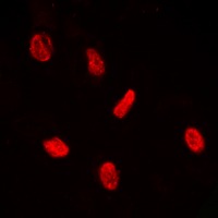 Anti-Phospho-PE2 (Thr526) Polyclonal Antibody