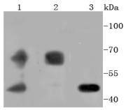 Anti-PDPK1 Antibody (6S392)
