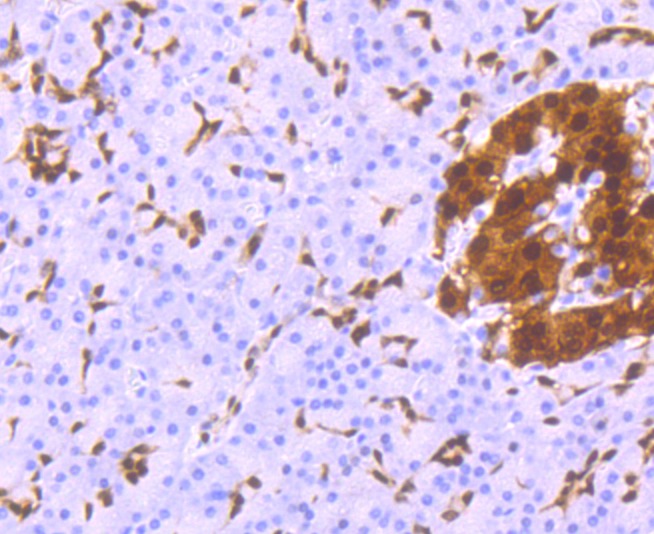 Anti-PDX1 Antibody (2P581)
