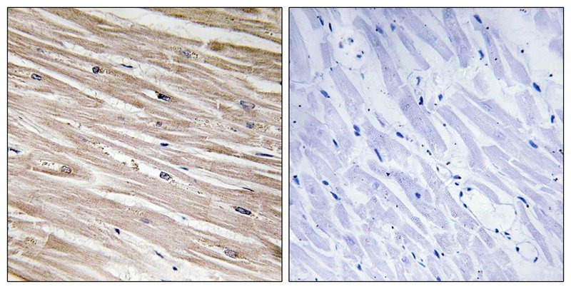 Anti-Phospho-PEA15 (Ser104) Polyclonal Antibody