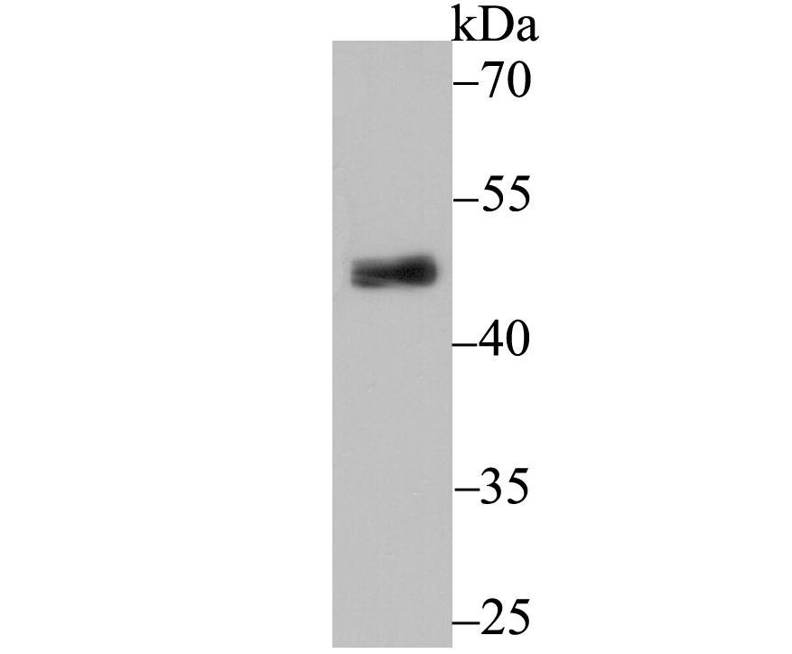 Anti-PDK2 Antibody (1C819)