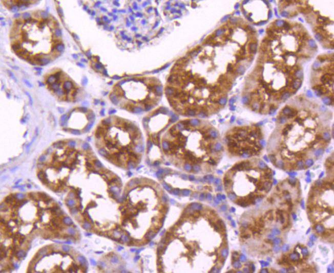 Anti-PDPK1 Antibody (6S392)