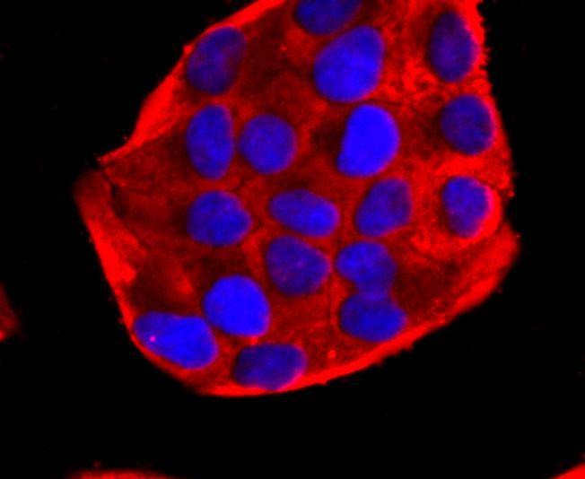 Anti-PDHA1 Antibody (9B780)