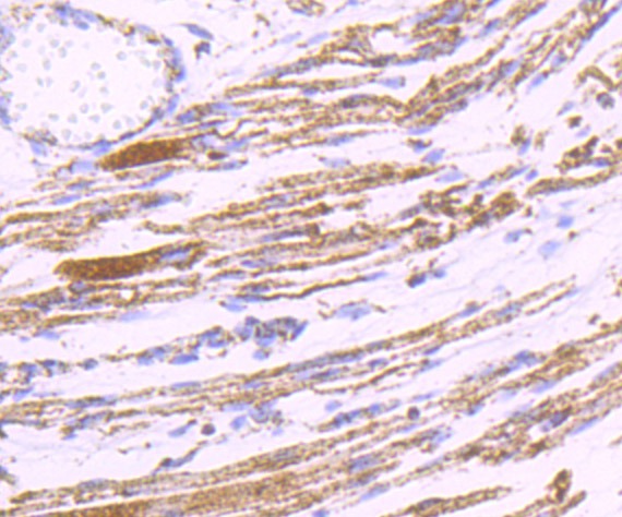 Anti-PDK2 Antibody (1C819)