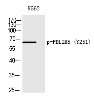 Anti-Phospho-PDLIM5 (Tyr251) Polyclonal Antibody