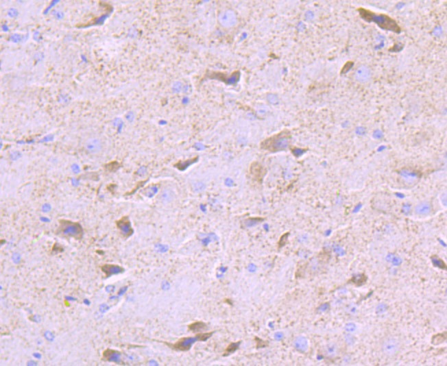 Anti-PDK2 Antibody (1C819)