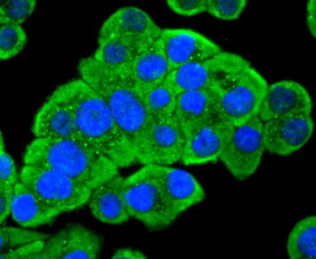 Anti-PDPK1 Antibody (6S392)