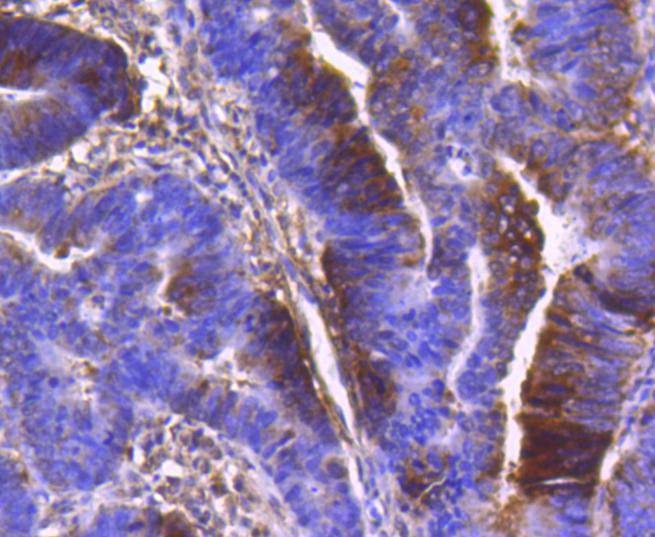 Anti-PDPK1 Antibody (6S392)
