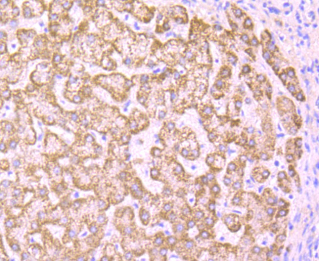 Anti-PCK2 Antibody (4S45)