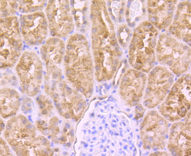 Anti-PCK2 Antibody (4S45)