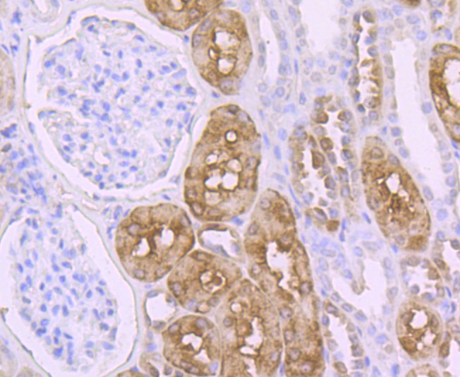 Anti-PCK1 Antibody (7Q973)