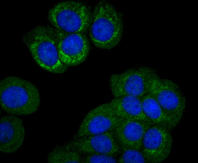 Anti-PCK2 Antibody (4S45)