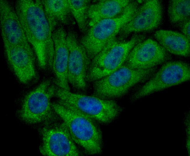 Anti-PCK2 Antibody (4S45)