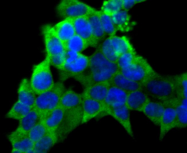 Anti-PCK1 Antibody (7Q973)
