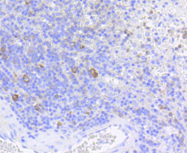 Anti-Phospho-EIF4E (Ser209) Antibody (4B622)