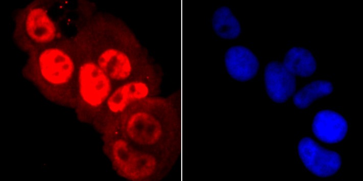 Anti-Phospho-POLR2A (Ser5) Antibody (1R812)