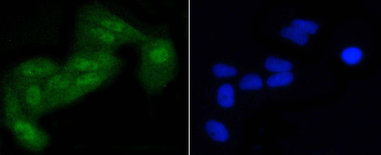 Anti-Phospho-eIF2α (Ser51) Antibody (1F908)