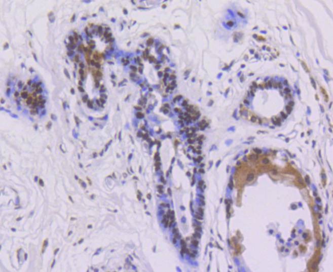Anti-Phospho-ER alpha (Ser118) Antibody (5S971)