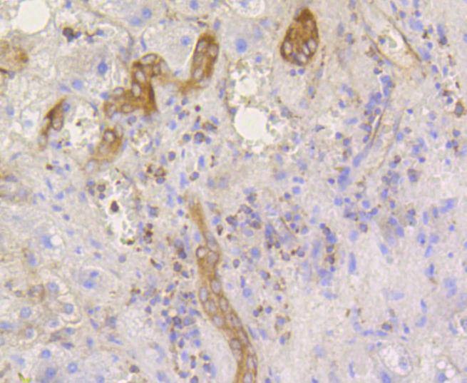 Anti-Phospho-eIF2α (Ser51) Antibody (1F908)