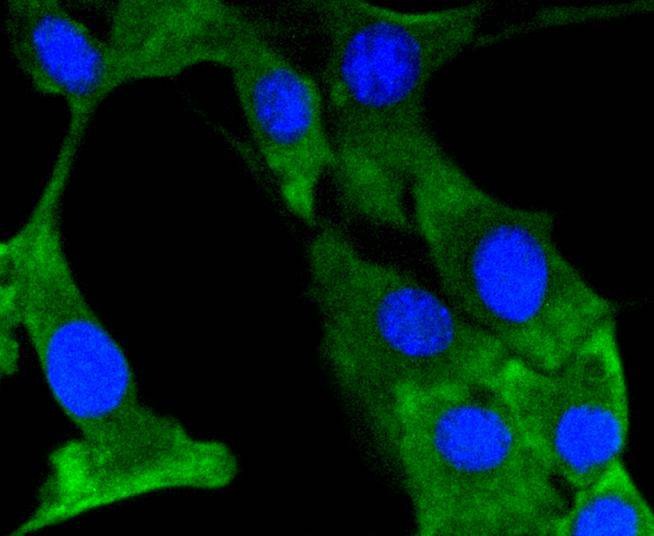 Anti-Phospho-PTK2 (Tyr397) Antibody (9L726)