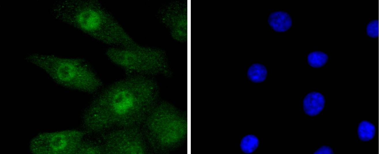 Anti-Phospho-ERK1/2 (Thr185) Antibody (1B497)