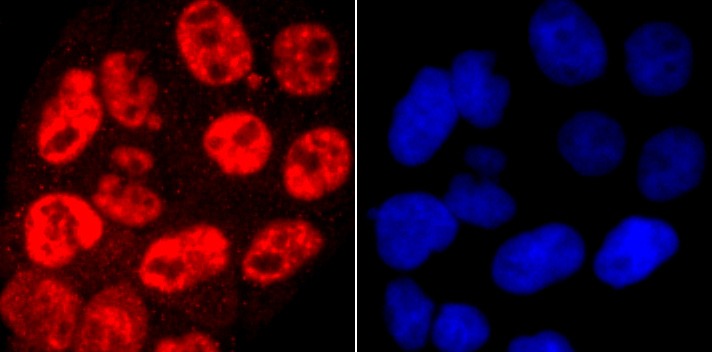 Anti-Phospho-POLR2A (Ser5) Antibody (1R812)