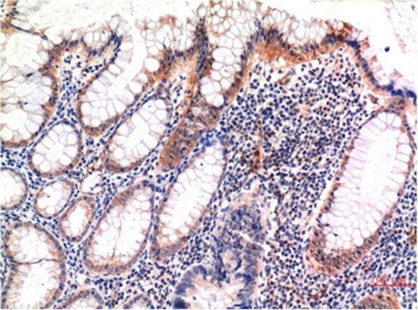 Anti-Phospho-MLKL (Ser358) Antibody (7H654)