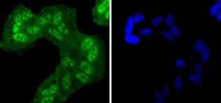 Anti-Phospho-EGFR (Tyr1068) Antibody (4G610)