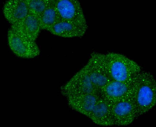 Anti-Phospho-CDC42 (Ser71) Antibody (7R21)