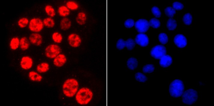 Anti-Phospho-POLR2A (Ser2) Antibody (2B504)