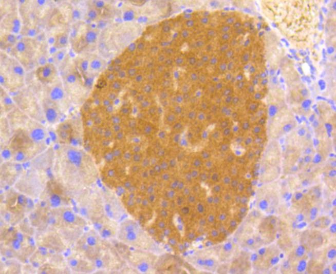 Anti-Phospho-PP2A (Tyr307) Antibody (2E533)