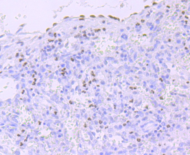 Anti-Phospho-POLR2A (Ser5) Antibody (1R812)