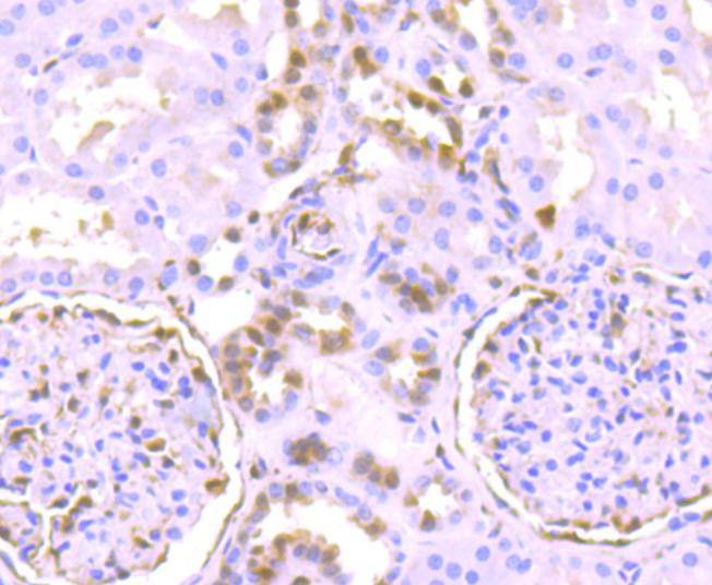 Anti-Phospho-ERK1/2 (Thr185) Antibody (1B497)