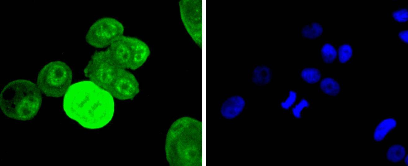 Anti-Phospho-EGFR (Tyr1068) Antibody (4G610)