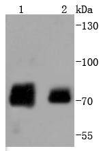 Anti-Phospho-RAF1 (Ser259) Antibody (2M259)
