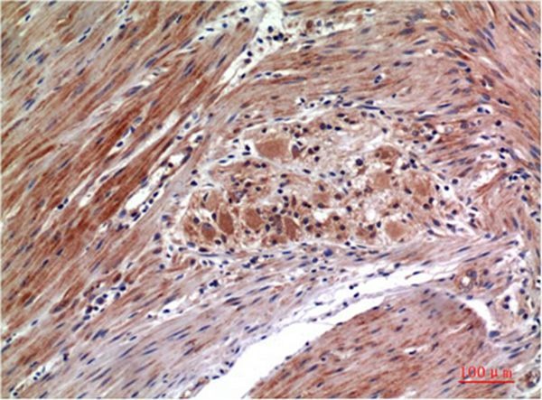 Anti-Phospho-ERK1/2 (Tyr222/205) Antibody (9X28)
