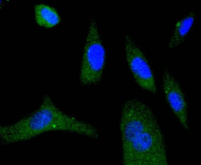 Anti-Phospho-EIF4E (Ser209) Antibody (4B622)