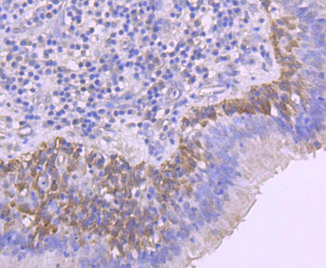 Anti-Phospho-CDC42 (Ser71) Antibody (7R21)