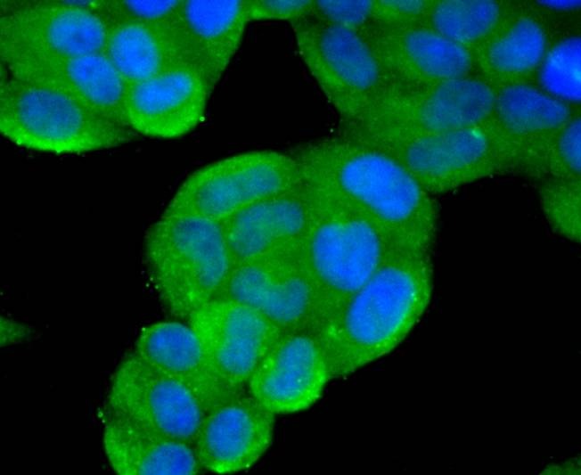 Anti-Phospho-PTEN (Ser380) Antibody (6S492)