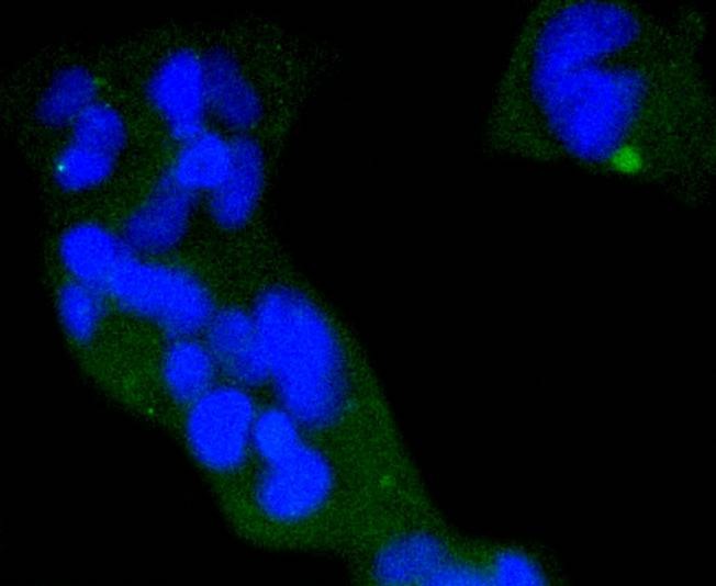 Anti-Phospho-EIF4E (Ser209) Antibody (4B622)