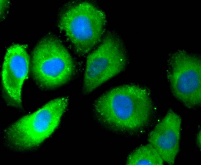 Anti-Phospho-ER alpha (Ser118) Antibody (5S971)
