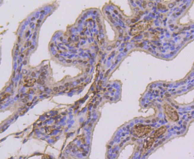Anti-Phospho-ER alpha (Ser118) Antibody (5S971)