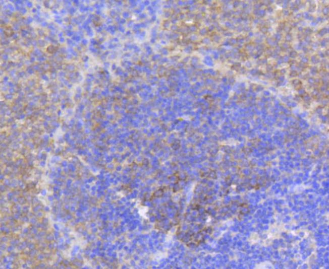 Anti-Phospho-EIF4E (Ser209) Antibody (4B622)