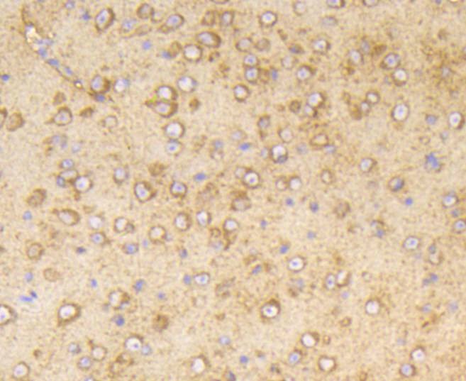 Anti-Phospho-PP2A (Tyr307) Antibody (2E533)