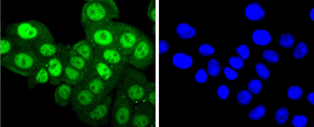 Anti-Phospho-PRKCA (Thr638) Antibody (1C677)