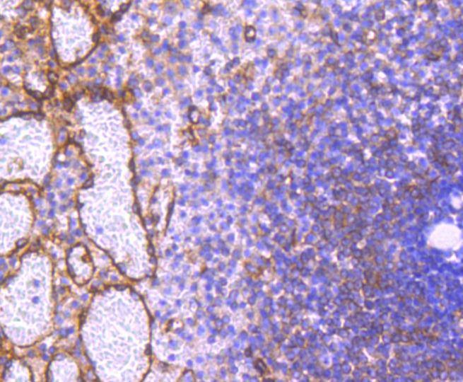 Anti-Phospho-PRKAR2A (Ser99) Antibody (9R534)