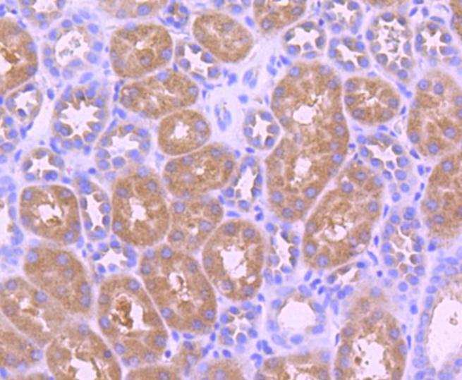 Anti-Phospho-NTRK2 (Tyr817) Antibody (6J201)